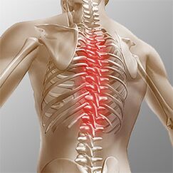 Spinal cord tumors of the thoracic spine