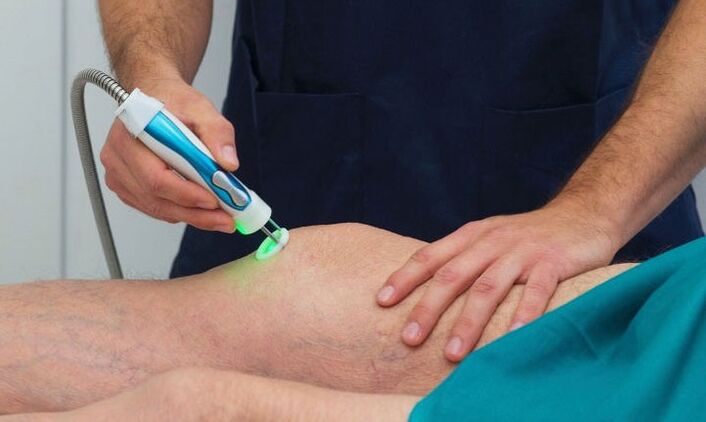 Measure the temperature of the knee joint with arthritis